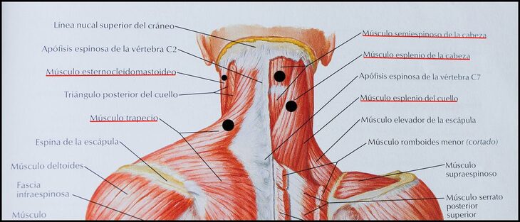 Músculos-cervicales-posteriores